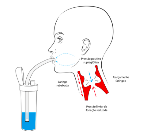 BOTELLA ETVSO: EJERCICIOS DEL TRACTO VOCAL SEMIOCLUIDO - Imagen 2